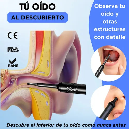 Limpiador de oídos con cámara -Dile adiós a los oídos tapados: limpia con visión HD y precisión total